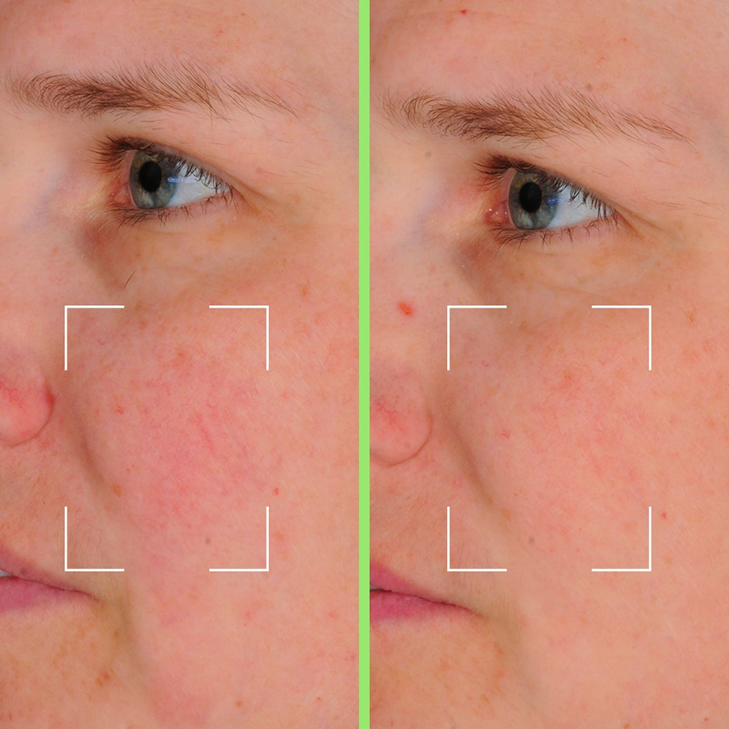 Cápsulas Skin Perfect