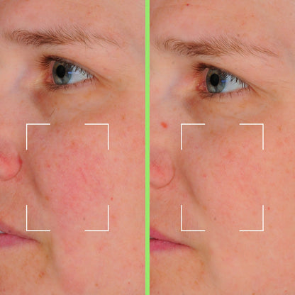 Cápsulas Skin Perfect